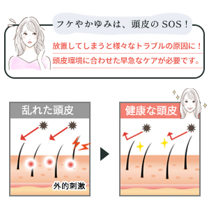 フケやかゆみは頭皮のSOS